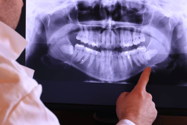 Best Emergency Dental Care for Abscessed Tooth in Hugo, OK