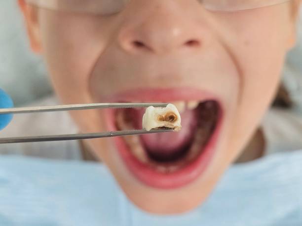 Best Mobile Emergency Dentist in Hugo, OK